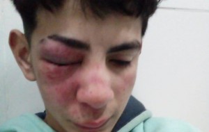 Bella Vista: denuncian amenazas y golpes de policías a menores